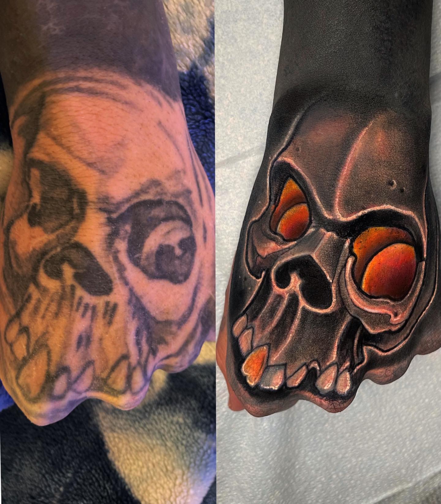 Skull realism tattoo on the forearm by Greg West Sac tattoo artist, West Sacramento, California
