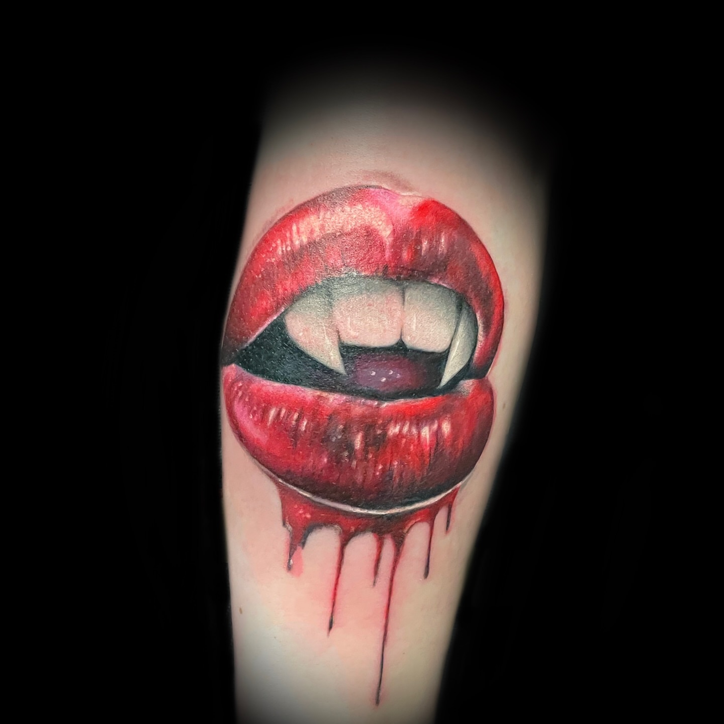 Vampire lips realism tattoo on the forearm by โ๏ธ ๐๐ป๐ธ๐ธ๐ด๐ฎ๐ต๐ต๐ฎ ๐๐ธ๐ถ๐ซ๐ผ๐ฑ๐ฎ๐ต๐ต๐ฎ โ๏ธ