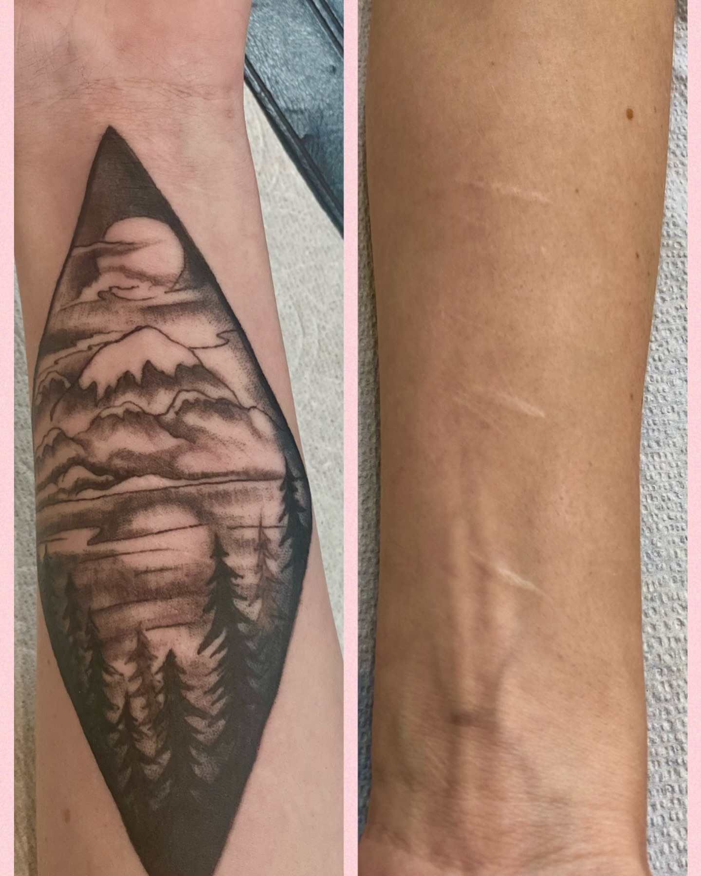 Tattoo by @vyvyn — black_and_grey