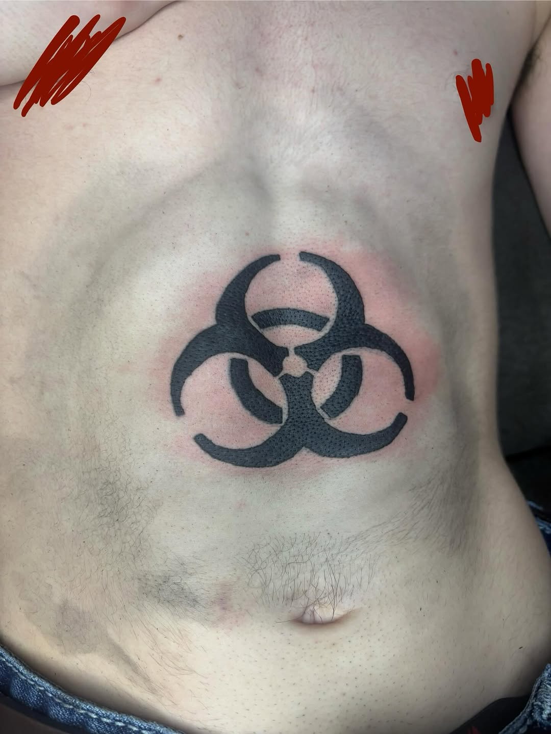 Biohazard symbol tattoo on the chest by sams tattoos