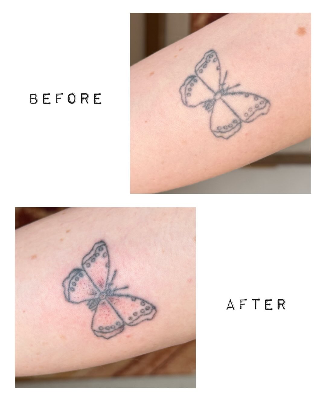 Tattoo by @babybeartattoos β dotwork
