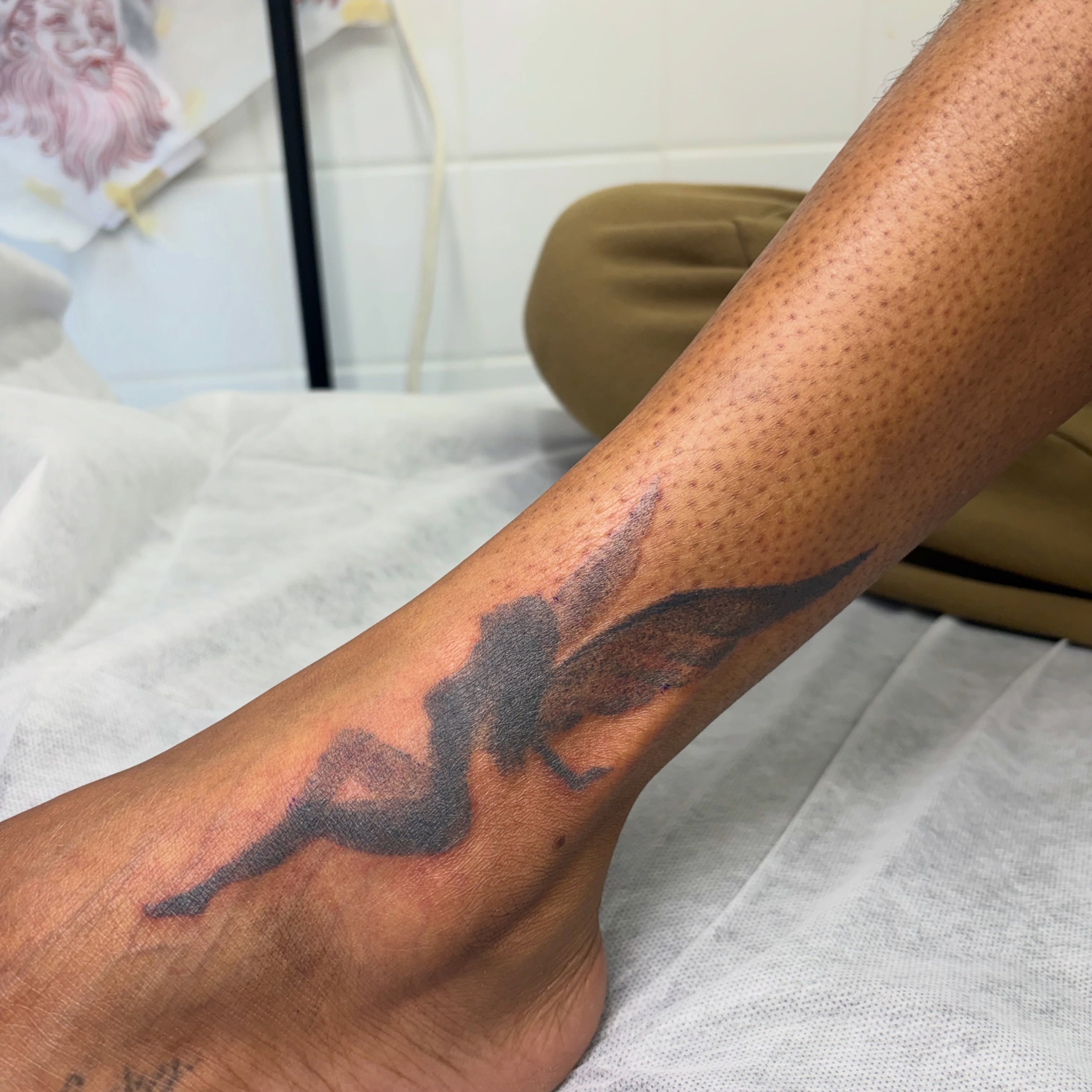 Tattoo by @mushypokes — black_and_grey