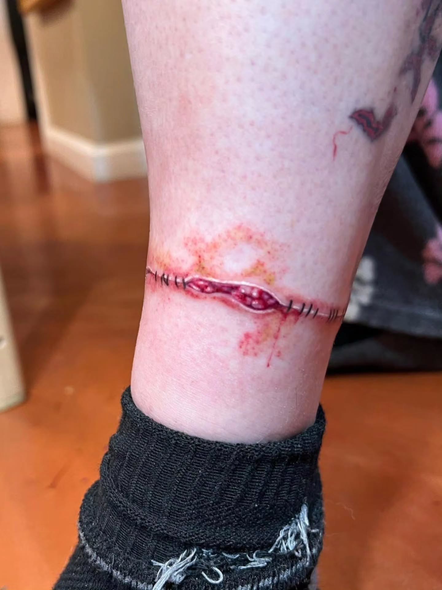 Tattoo by @broken.teeth.tattoos — realism