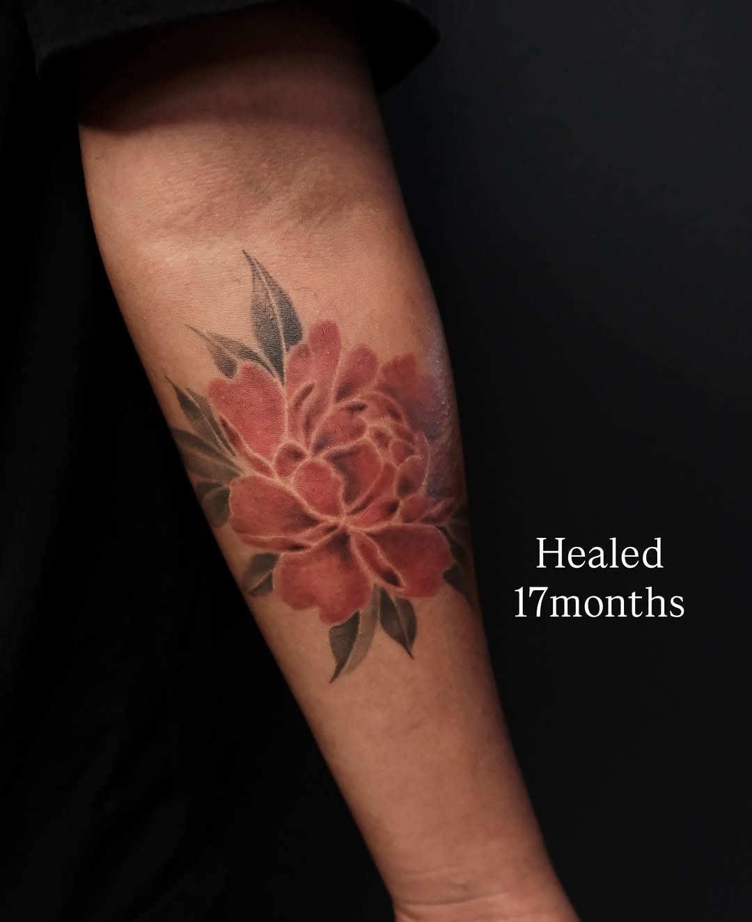 Peony realism tattoo on the forearm by Vu Nguyen