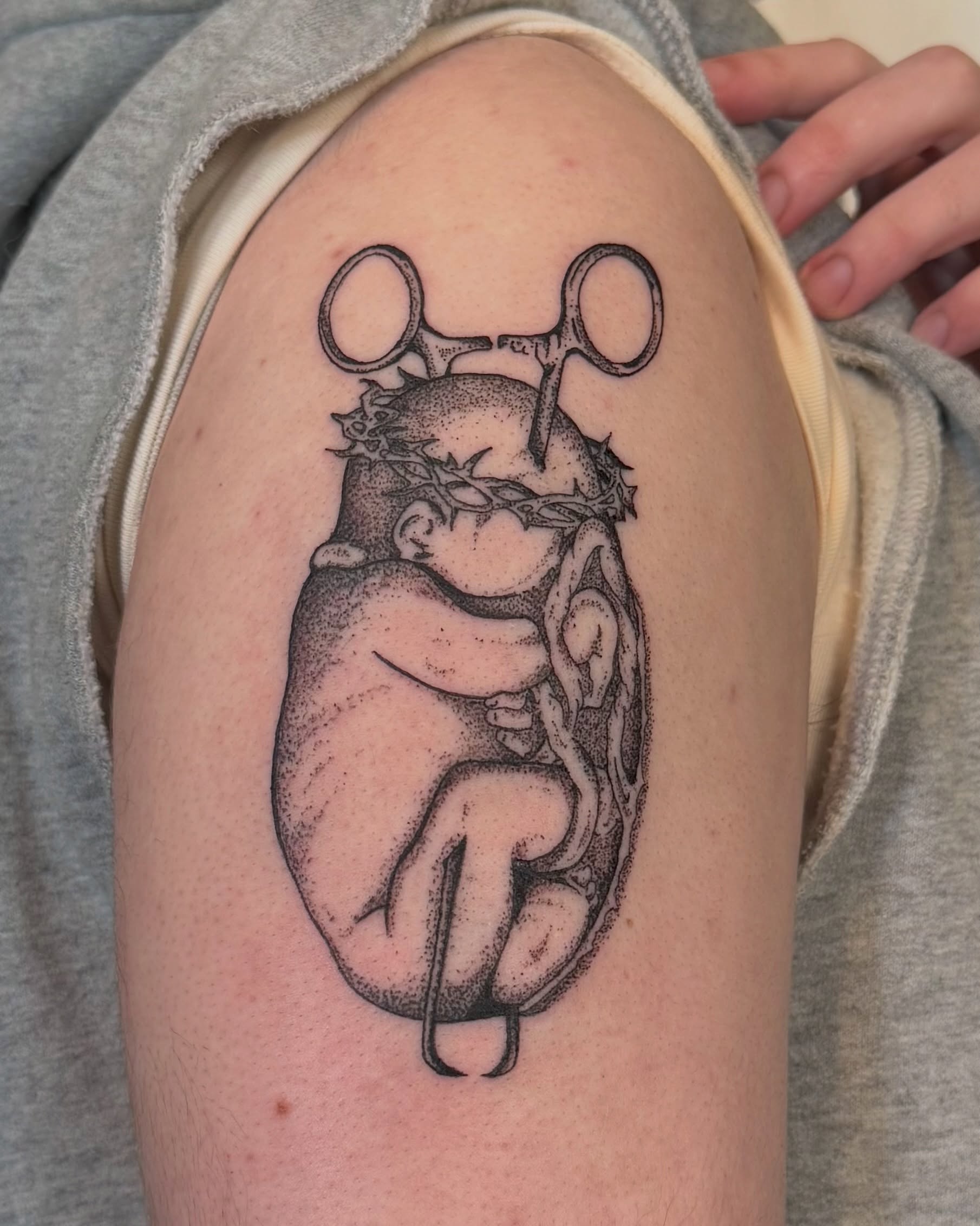 Fetus and surgical scissors dotwork tattoo on the shoulder by jake.inks