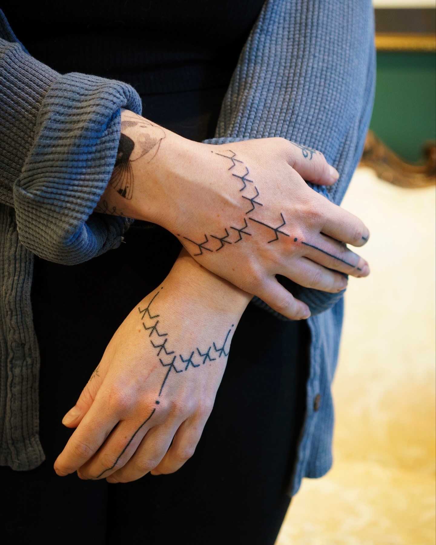 Stitch marks black and grey tattoo on the hand by 思Stacy