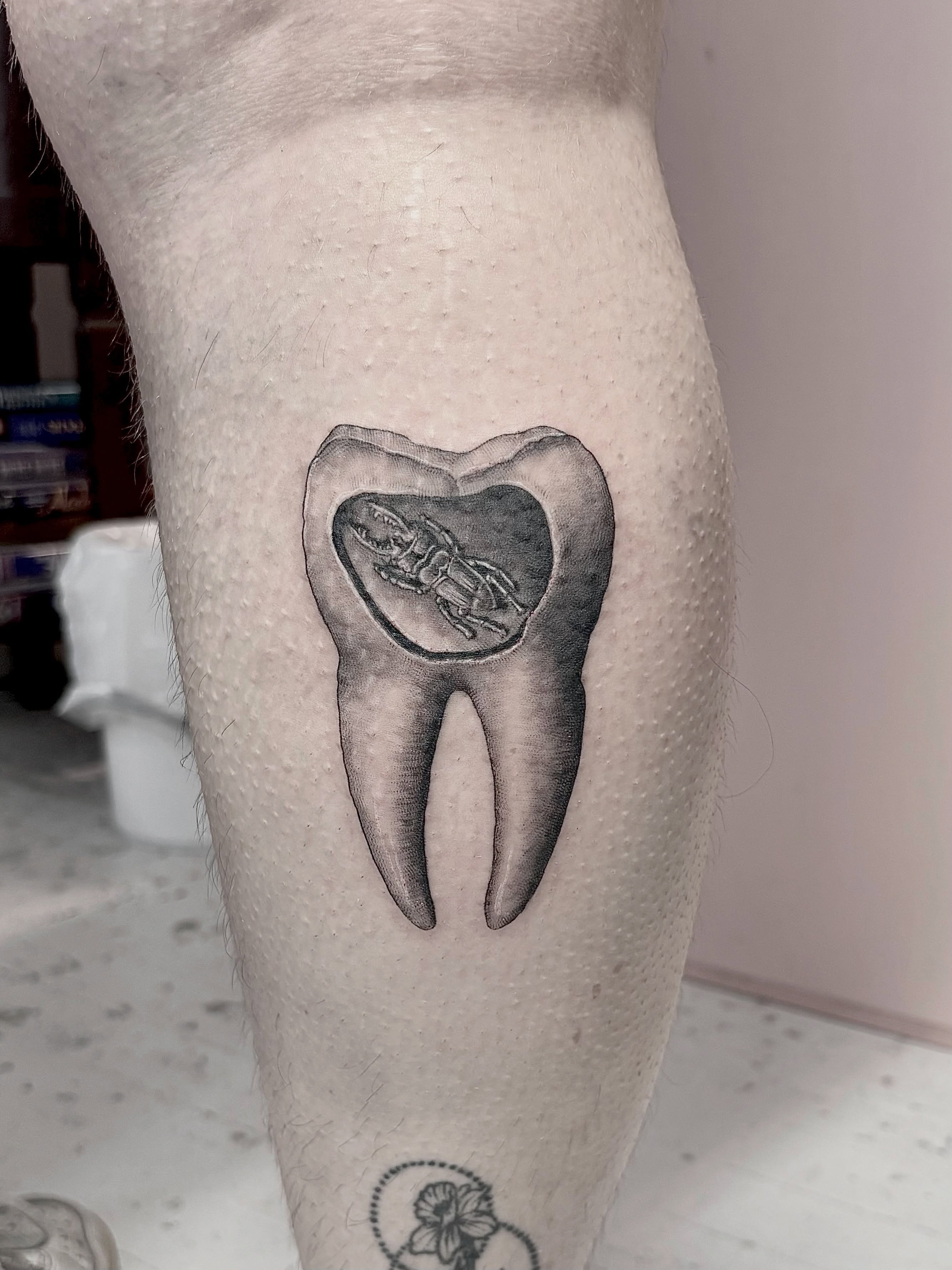 Tooth with insect realism tattoo on the forearm by <3 eve’s tattoos <3